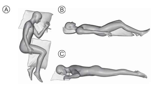 Diagram of recommended side and back sleep positions versus not-recommended stomach sleep